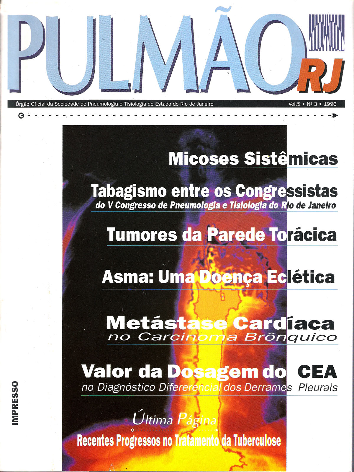 Revista Pulmão RJ 1996 - Número 3