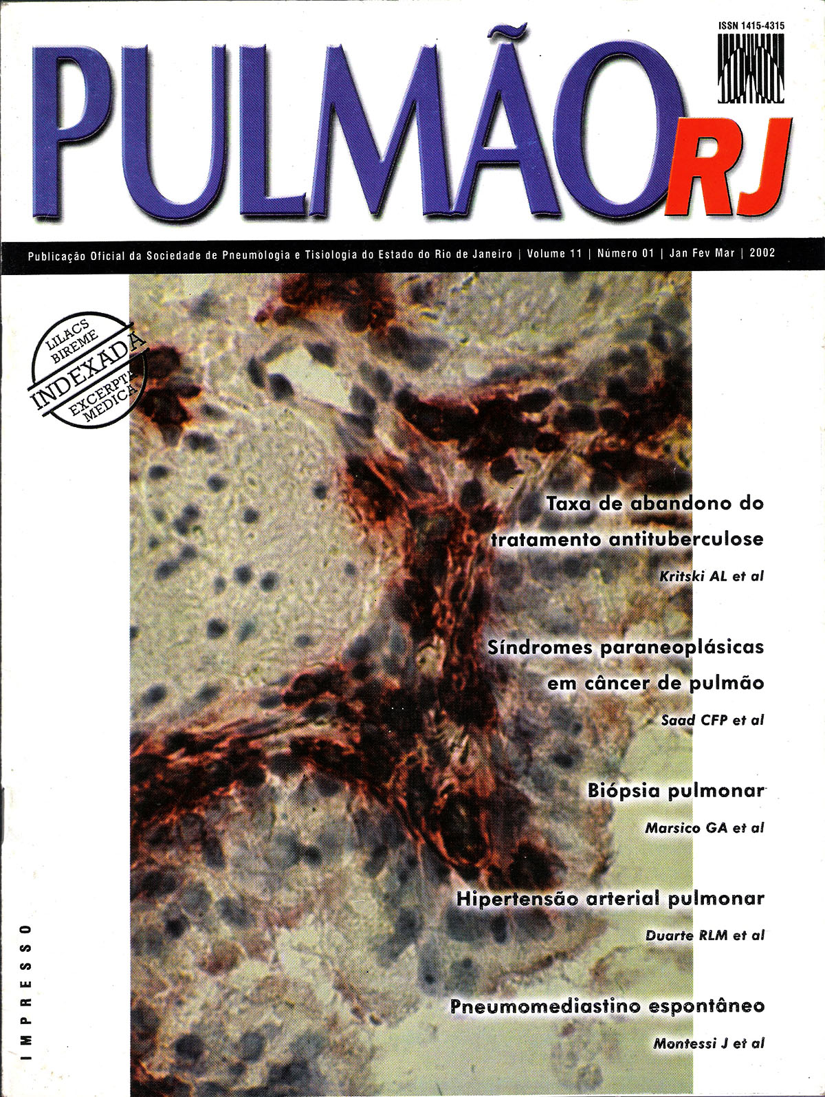 Revista Pulmão RJ 2002 - Número 1