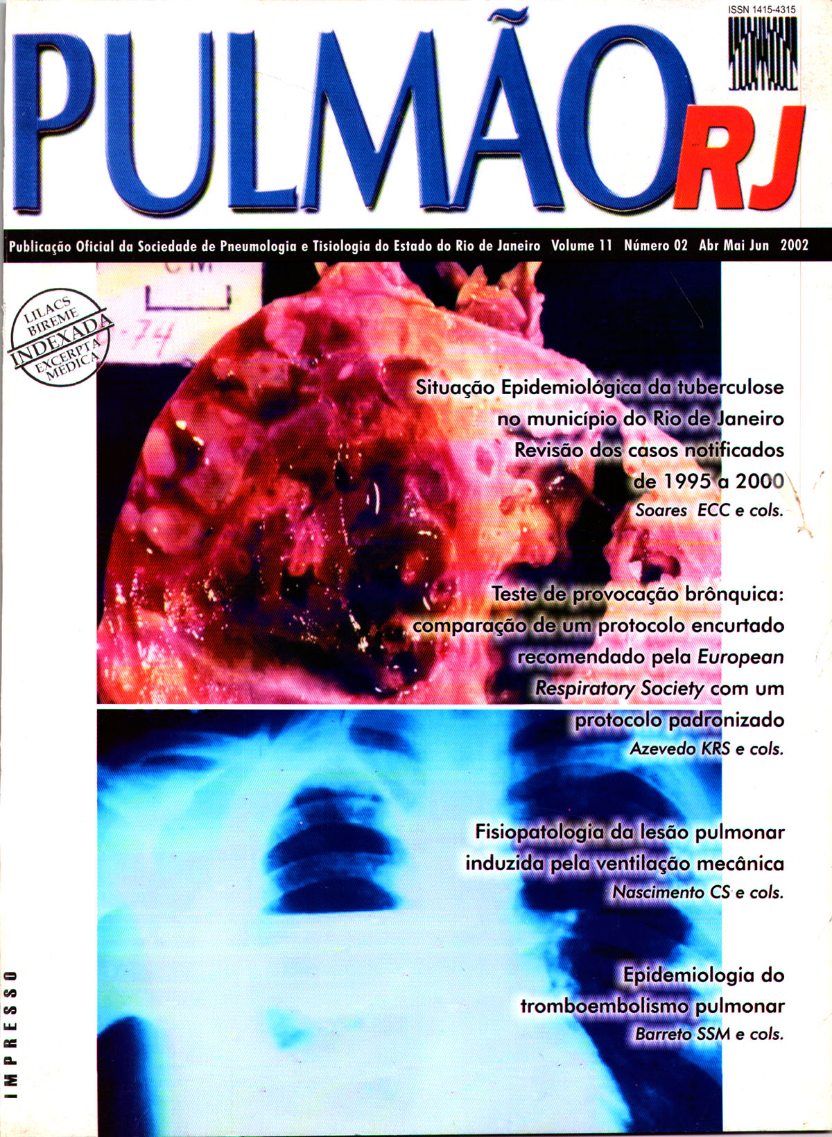 Revista Pulmão RJ 1991 - Número 1